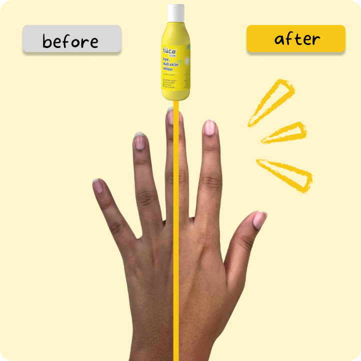TuCo Kids Bye, Dull Skin Lotion is a natural skincare solution for kids aged 3 and up. Crafted with Kakadu Plum for brightening, Shea Butter for deep hydration, and Turmeric to even out skin tone, this lotion reduces dark spots and leaves skin soft, smooth, and healthy.